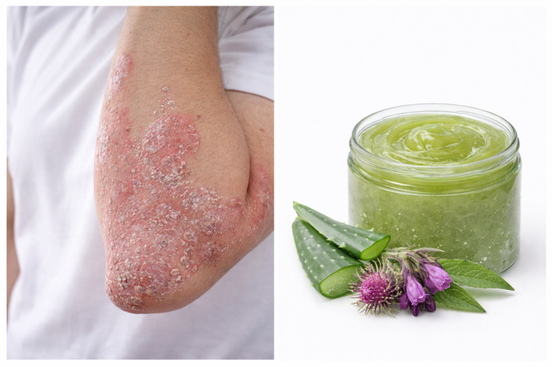 Tajna starog priručnika za psorijazu